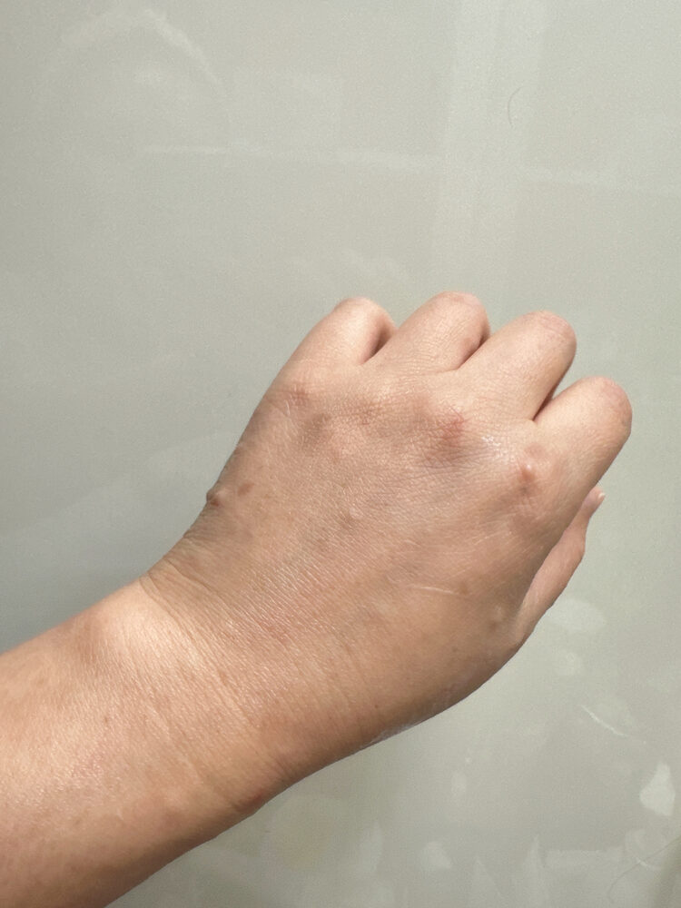 Customer photo of ABELTY Rice Niacinamide Moisture Day Serum